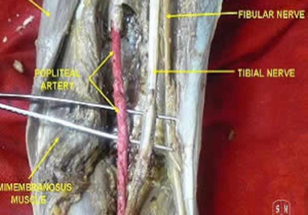 Dynamic ultrasound for detecting soleus arcade syndrome