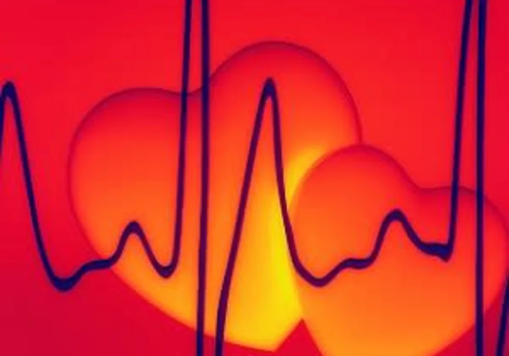 Catheter ablation better than drugs for treating AF