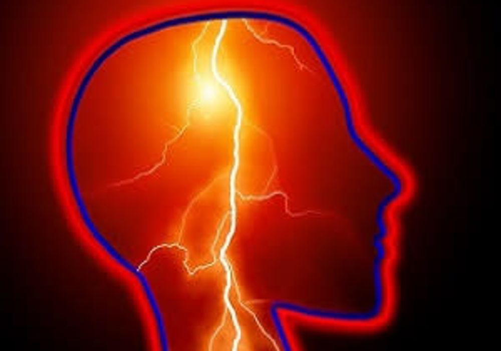 New guidelines for reducing stroke risk in women