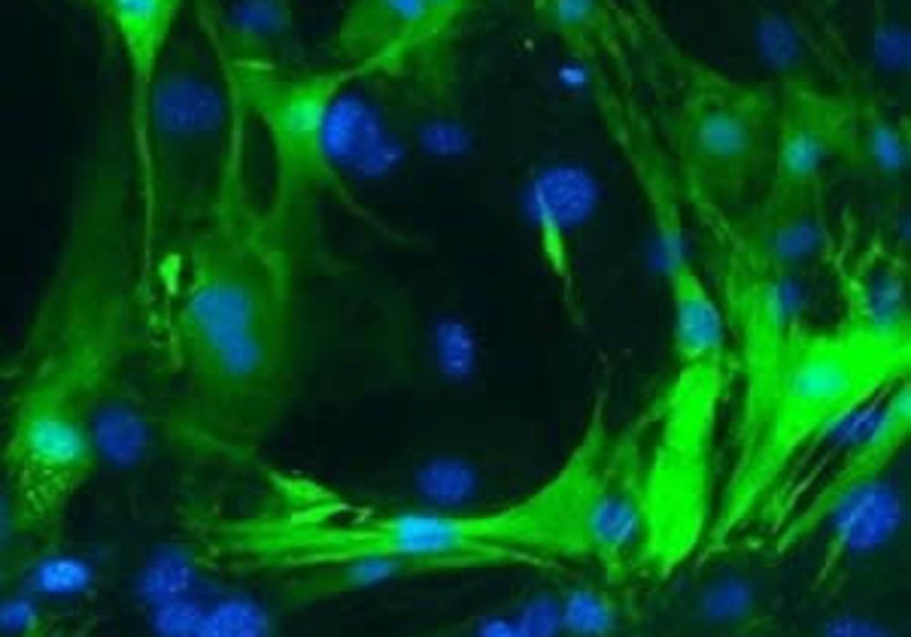 These cardiomyocytes (green with blue nuclei) had been fibroblasts before Frank Conlon&#039;s UNC lab reprogrammed them.