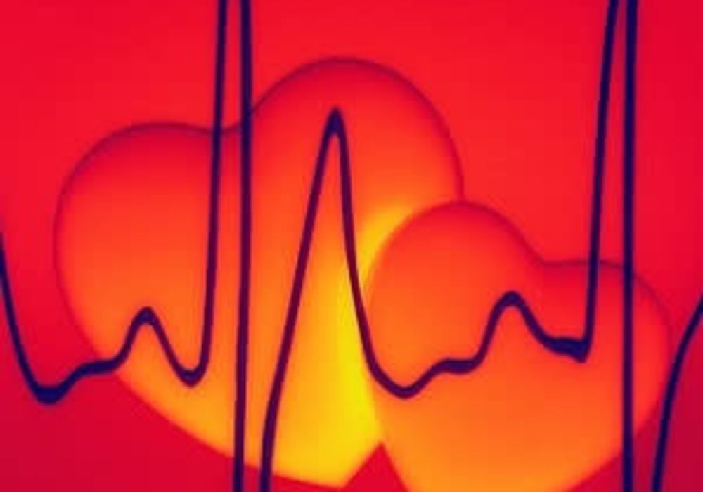 Depression increases risk for atrial fibrillation