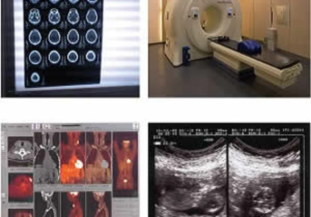 Mitigating radiation risk in medical imaging: expert opinion