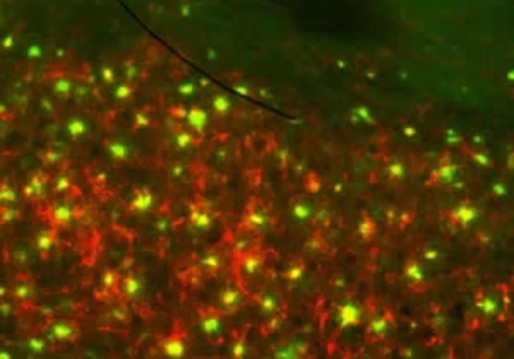 Brain section of a transgenic mouse for AD showing accumulations of amyloid plaques (green) and ferritin (red).