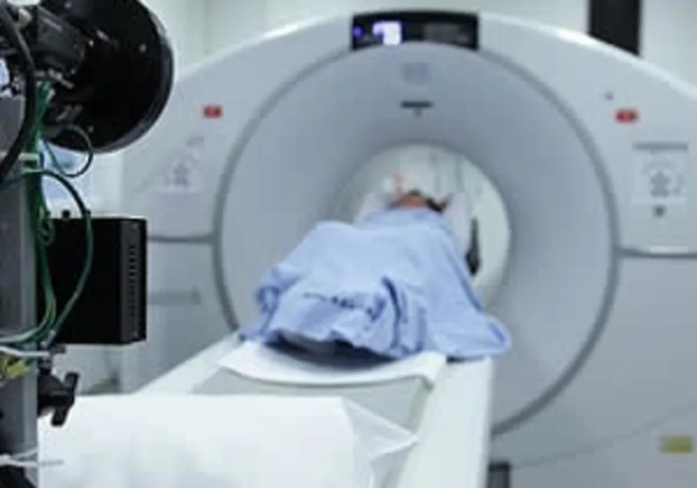 #ESC2018: CT scans reduce heart attack rates 