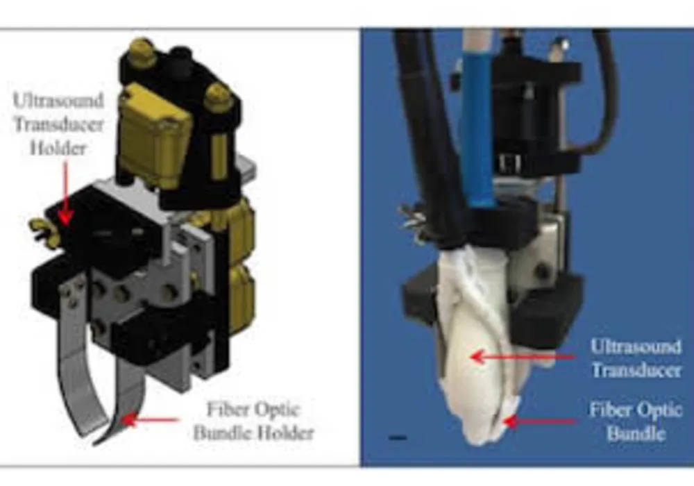 Purdue University researchers are developing a novel biomedical imaging system that combines optical and ultrasound technology to improve diagnosis of life-threatening diseases. The researchers have created a motorized photoacoustic holder that allows use