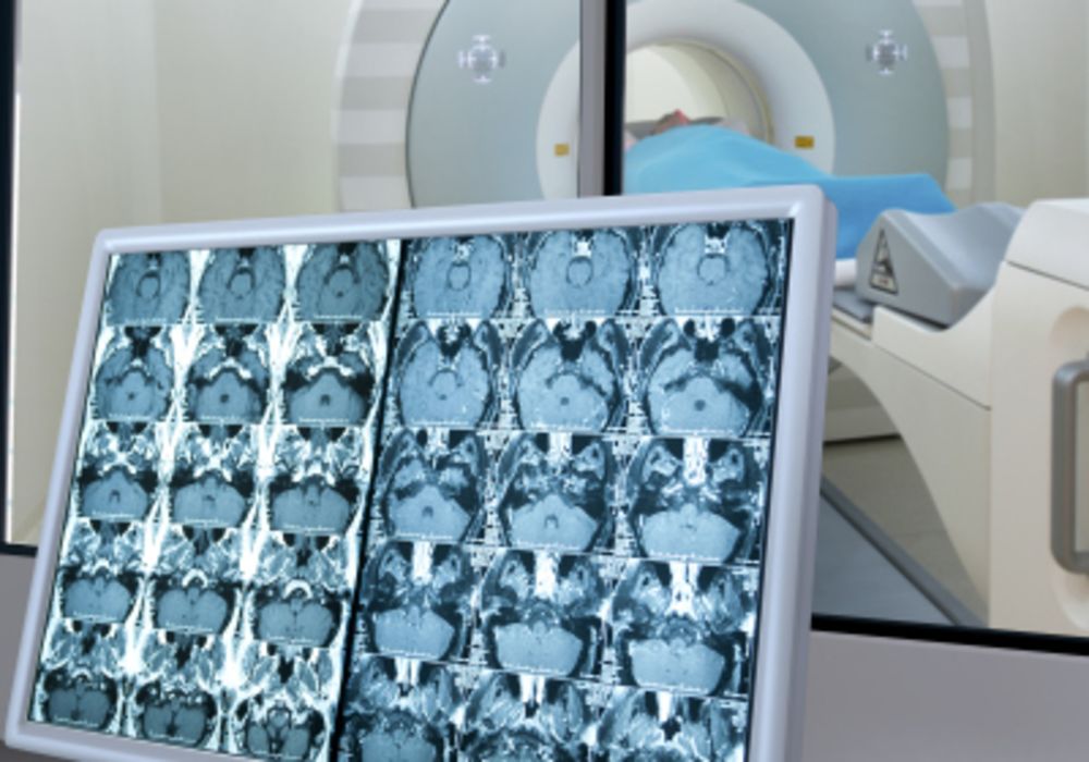 RRA: encouraging innovative research in radiology 