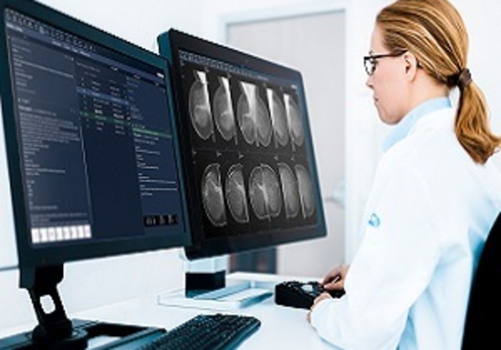 US-based Charlotte Radiology chooses Sectra as its breast imaging vendor