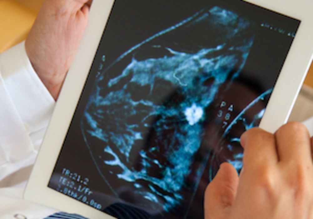 Latest AI applications in breast imaging