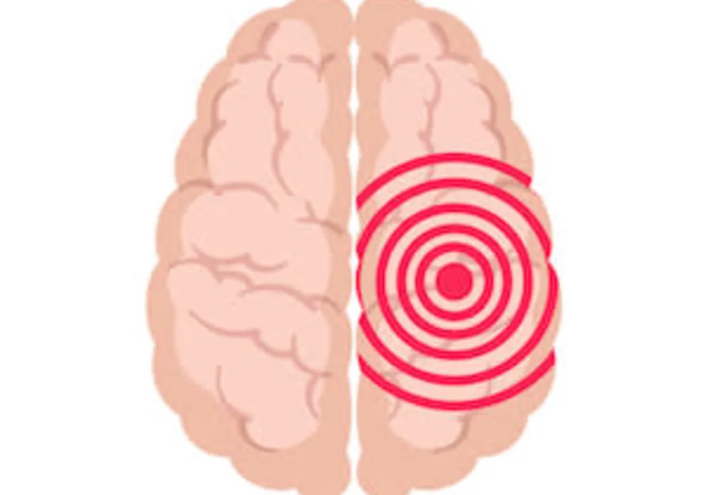 #SIR2019: Innovative training helps IR&#039;s save stroke patient lives 