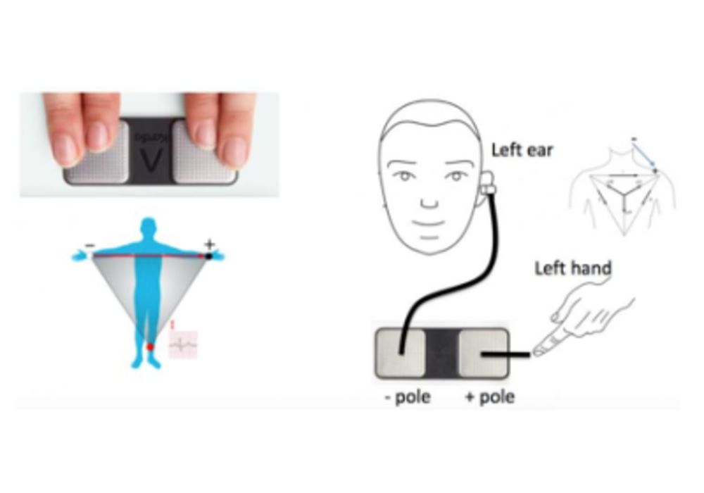 An ECG was first performed by the standard method using two hands (left photo) and then by a novel method with the ear and hand (right photo).