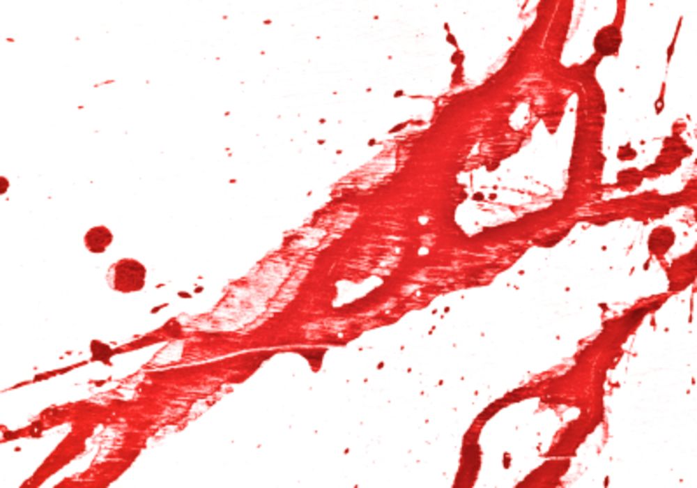 European guideline on managing post-traumatic bleeding: 5th edition 