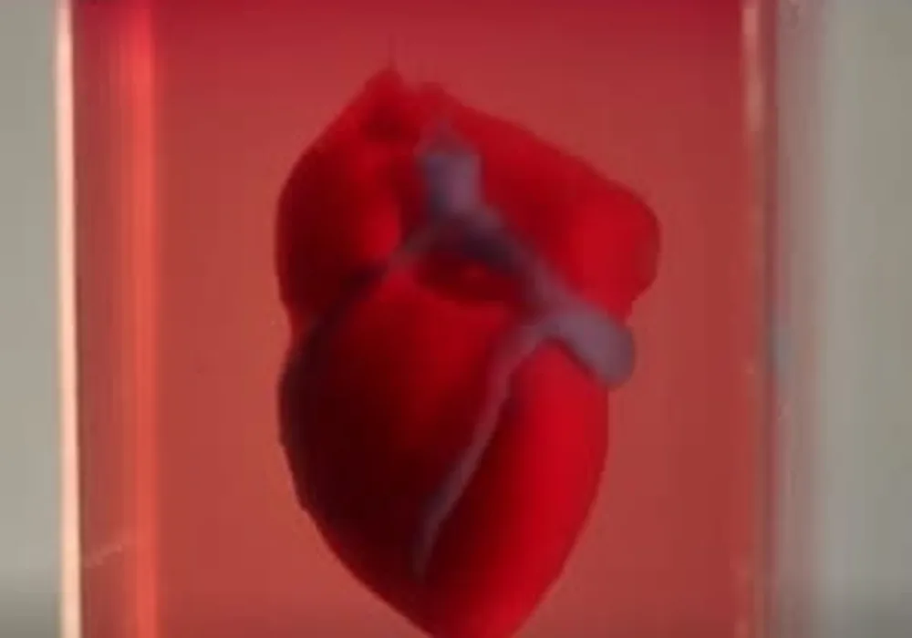 A 3D-printed, small-scaled human heart engineered from the patient&#039;s own materials and cells.