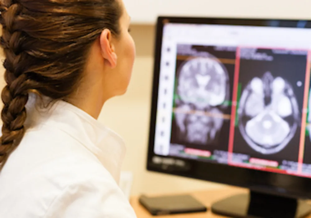 Machine learning cuts mammogram volume radiologists need to read 