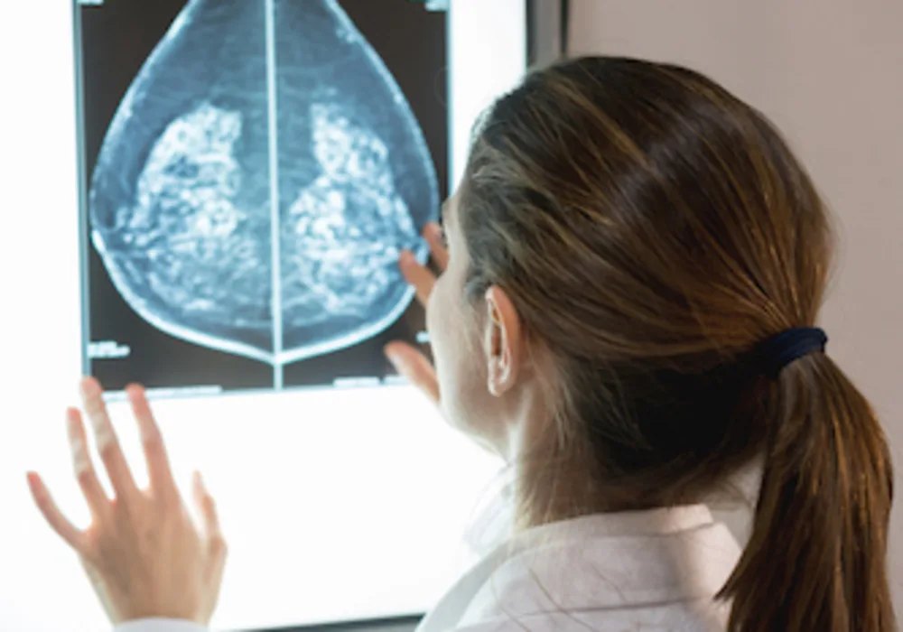 Dense breasts, breast cancer risk, and screening choices in 2019 