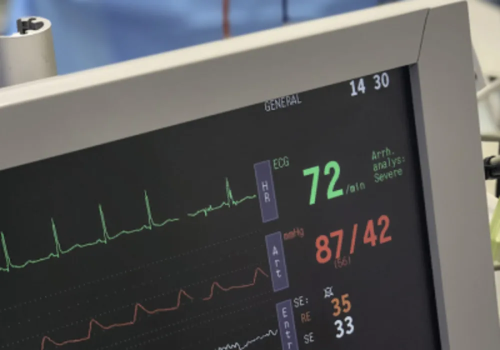 End-Tidal CO2 Levels vs. Arterial CO2 Levels in Children with TBI