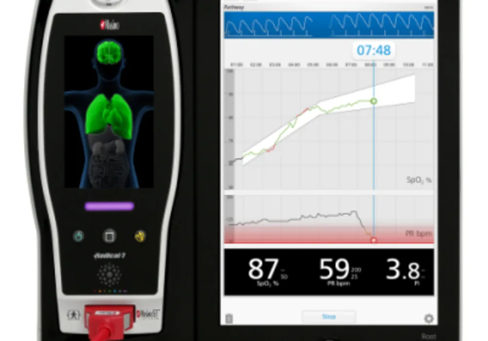 Masimo Announces Pathway&trade;, A Newborn Oxygenation Visualization Mode For The Root&reg; Patient Monitoring And Connectivity Platform 