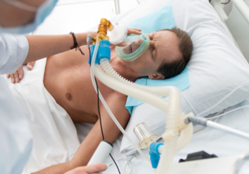 Noninvasive Ventilation in Early Stage Mild ARDS