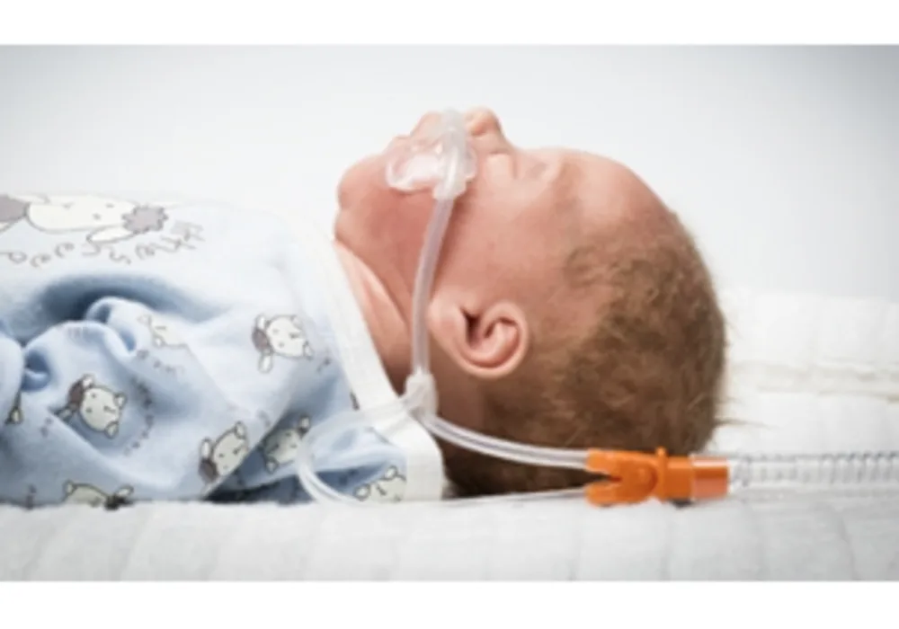 Nuflow&reg; Nasal Cannulas for HFOT in Neonates