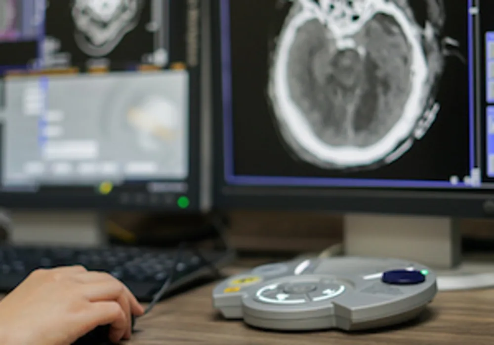 AI Radiological Image Analysis Pilot in Luxembourg 