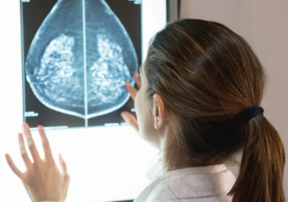 Tackling Urgent Breast Radiologist Shortage