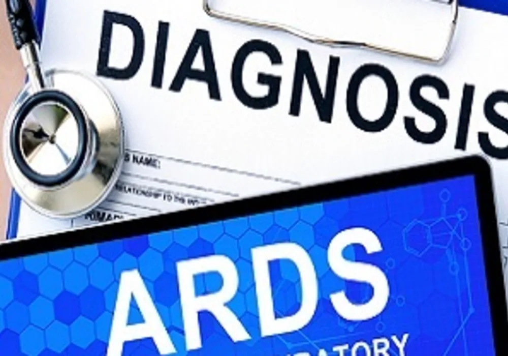 Cognitive Impairment After ARDS