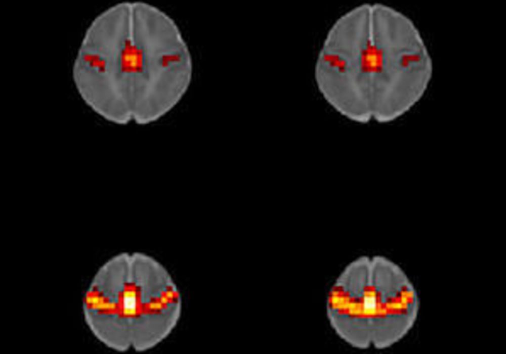 Prenatal Effect of Opioids