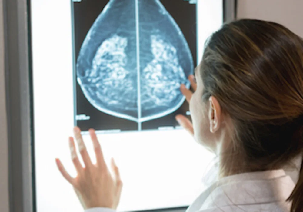 AI Breast Cancer Diagnosis Matches Two Doctors 