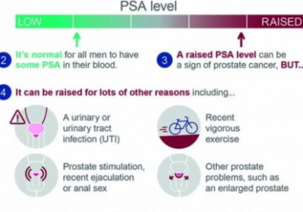 Prostate is Now Most Common Cancer
