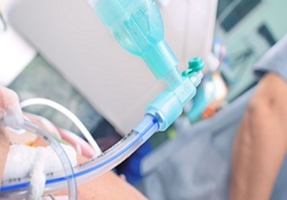 Oxygen Therapy in Acute Care Medicine