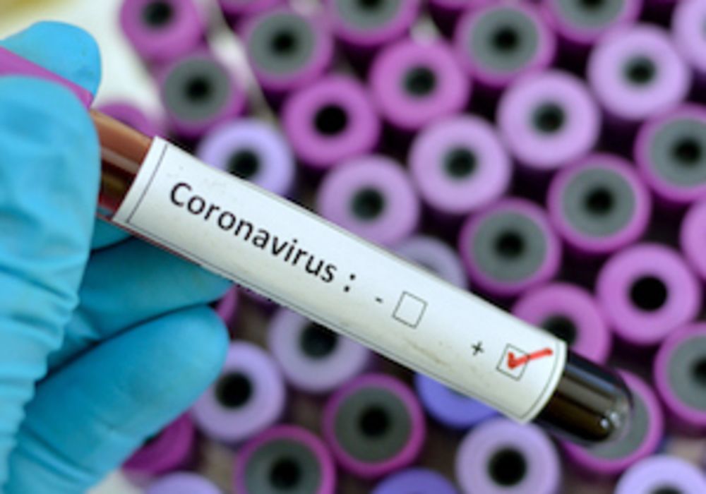 Coronavirus