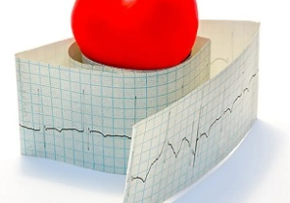 Lopinavir, Ritonavir Cause Bradycardia in Older COVID-19 Patients