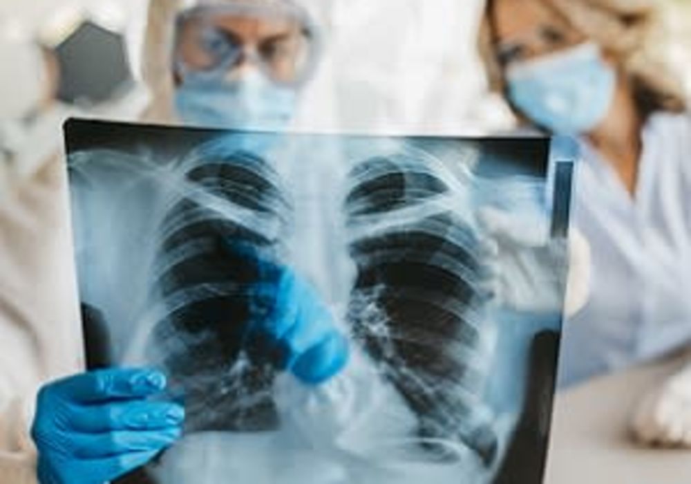 Lung Histopathology: COVID-19 Compared to SARS, H1N1