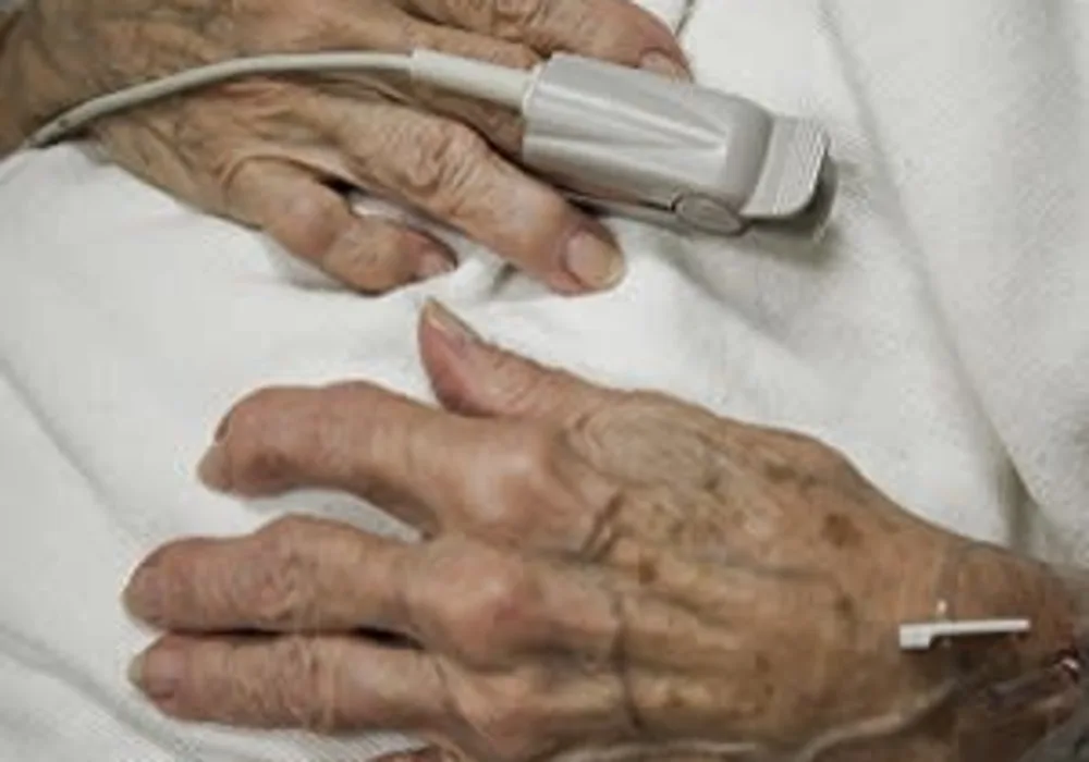 Use of Non-Invasive Ventilation in Critically Ill Older Adults 