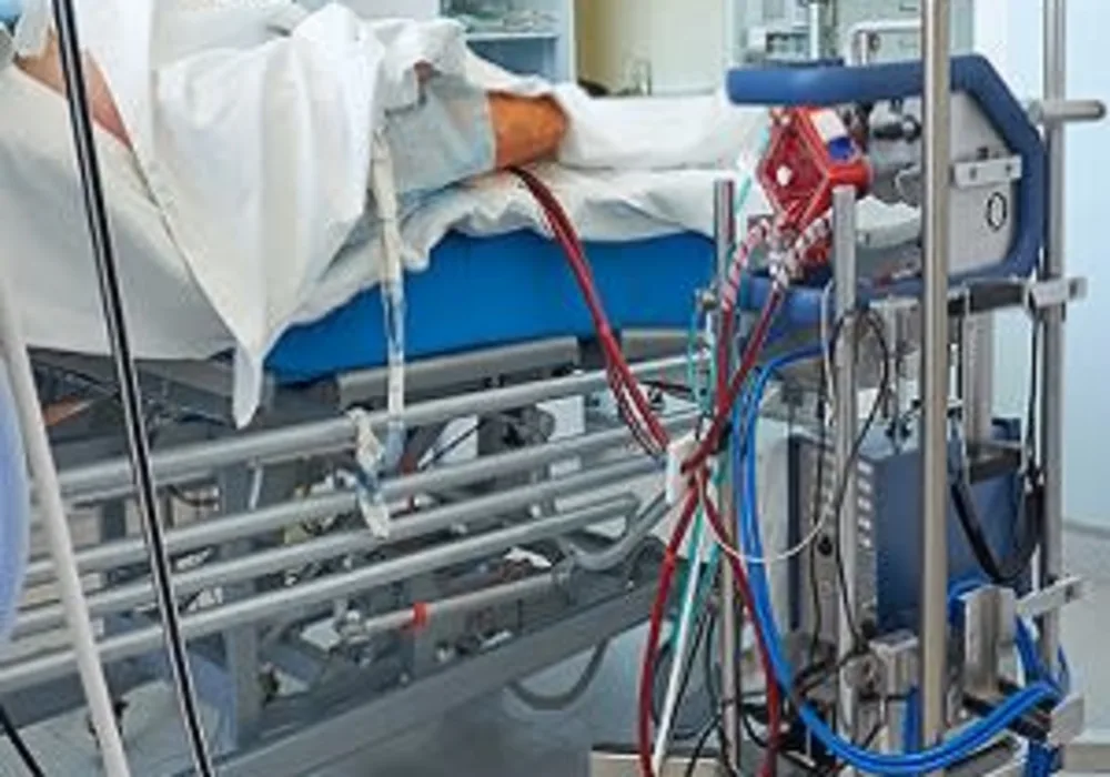 ECMO, Mortality and ARDS