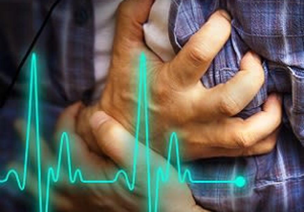 Sudden Cardiac Arrest More Often Fatal in People with COVID-19 