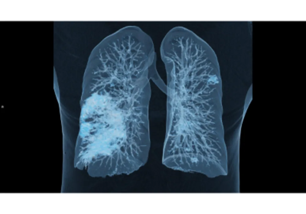 When COVID-19 Strikes, We Learn From The Traces It Leaves Behind