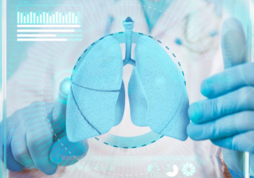 Deep Learning for Lung Cancer Treatments