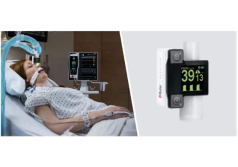 Masimo Announces FDA Clearance of Radius PCG&trade; for Root&reg; Patient Monitoring &amp; Connectivity Platform