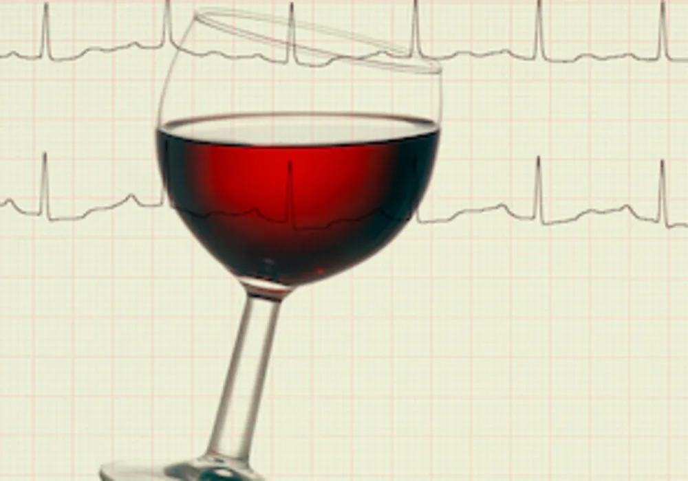 Increase in Stroke Risk With Greater Alcohol Intake