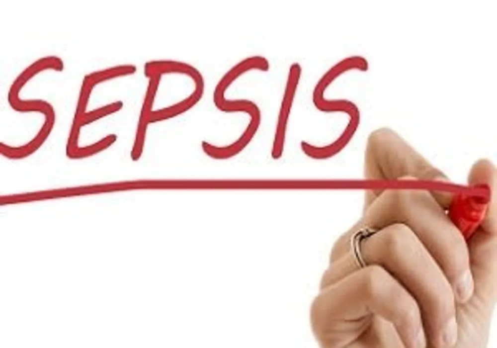 Association of Volume of Sepsis Cases and Mortality 