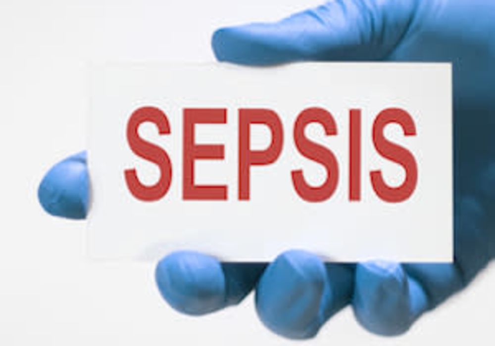 Trends in Sepsis-Related Mortality in the U.S. 