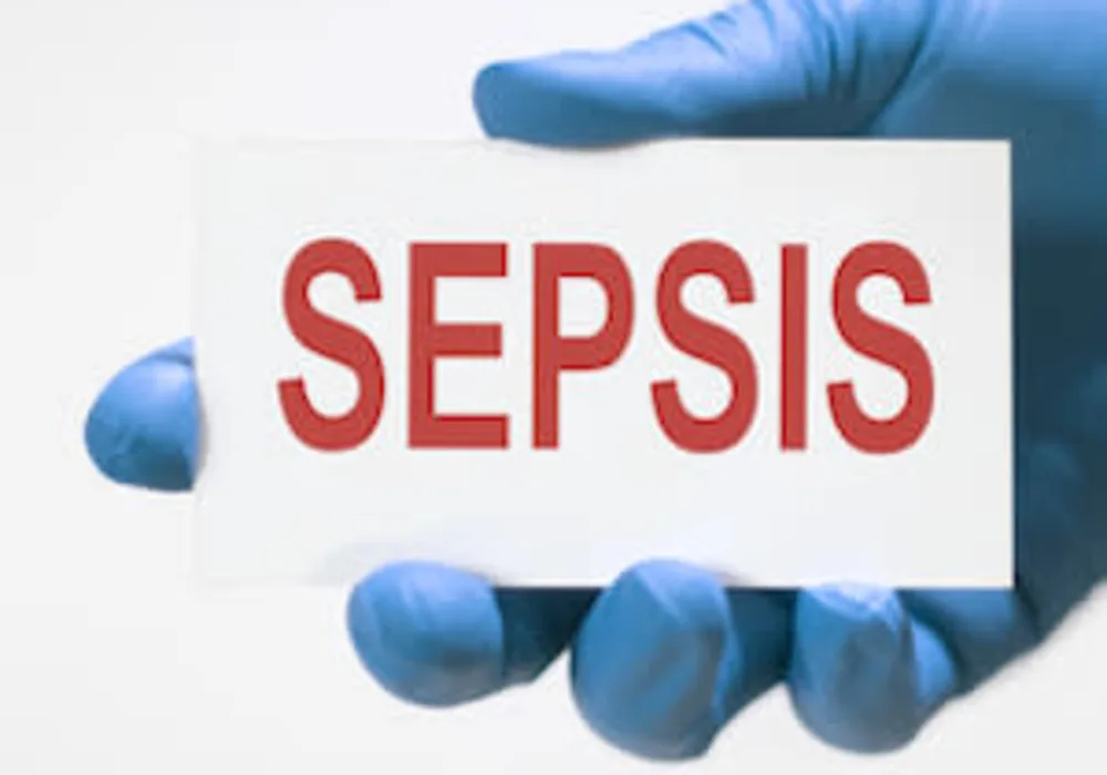 Trends in Sepsis-Related Mortality in the U.S. 