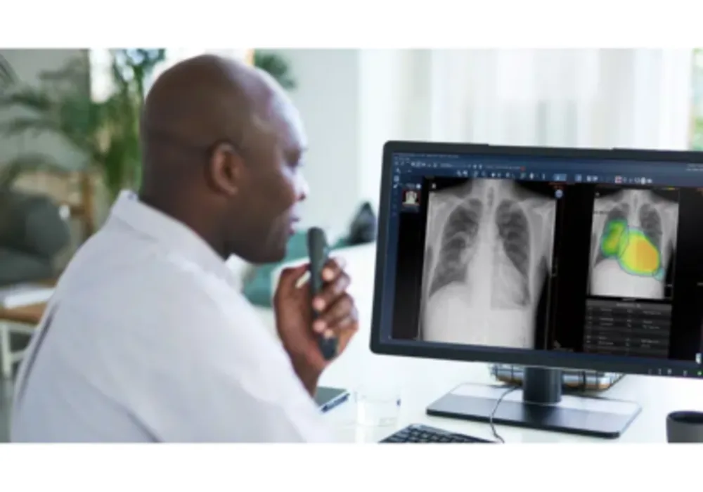 Chest X-Ray AI: Taking on Detection and Diagnosis Challenges in Chest X-Rays