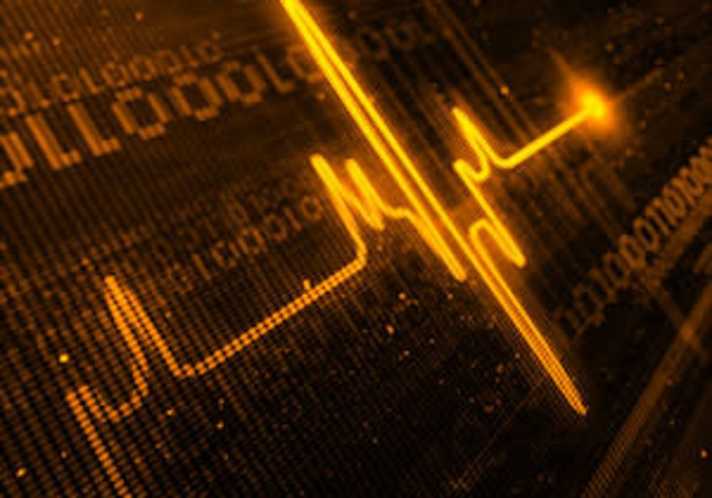 RESCUE-IHCA Mortality Prediction Score for IHCA 