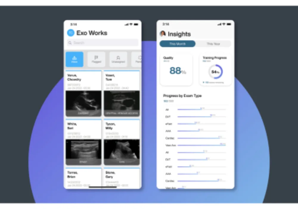 Exo&reg; Announces Mobile-First, Secure Cloud-Based Point-of-Care Ultrasound Workflow Solution