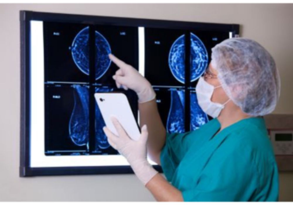 AI in Population Breast Screening Cuts Radiologist Workload by 63%