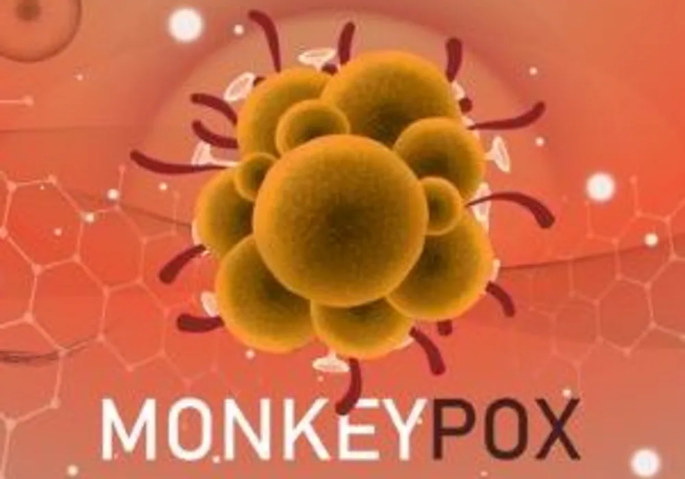 Monkeypox Spreads Around the World