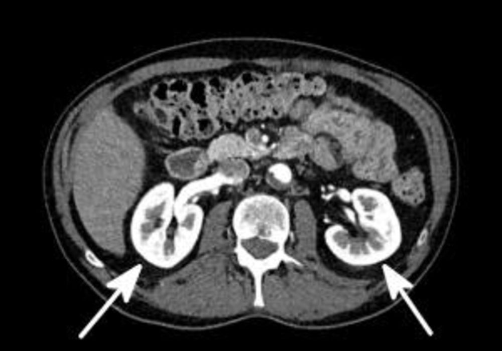 Contrast Agent Shortage Sends Ripples through Radiology