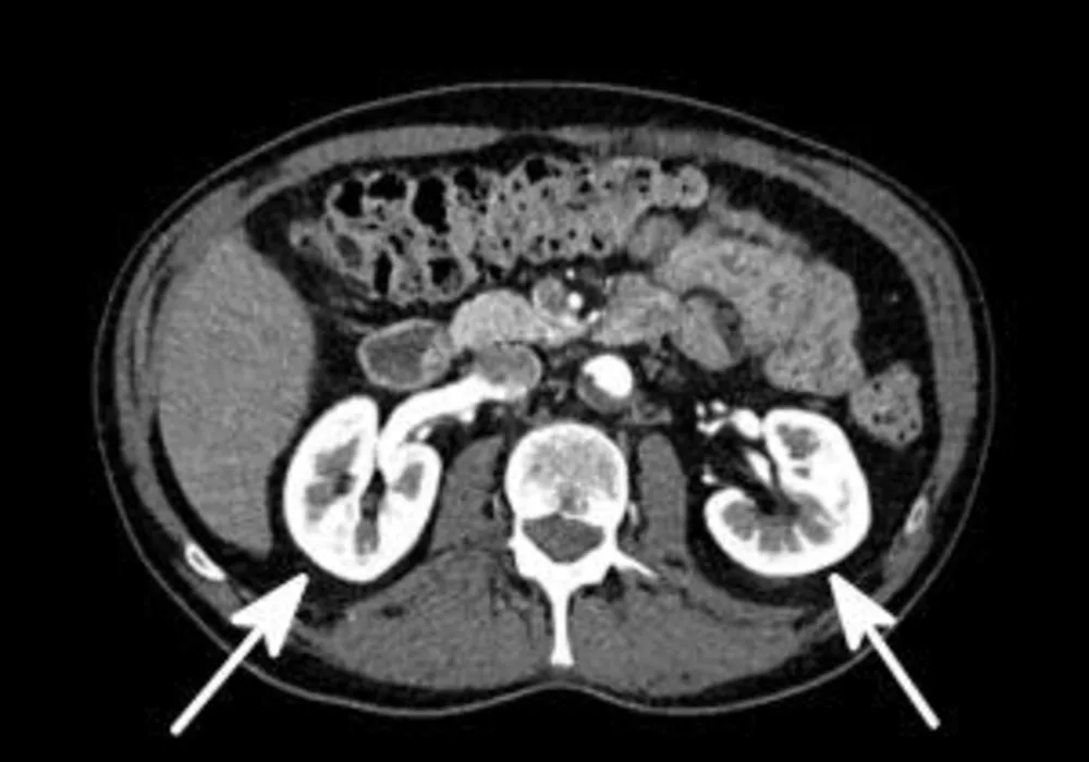 Contrast Agent Shortage Sends Ripples through Radiology