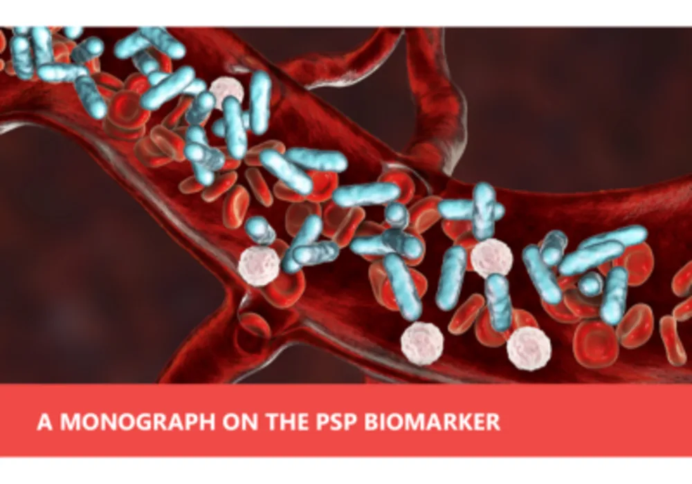 Pancreatic Stone Protein (PSP) Sepsis Test on the Abioscope&reg; Point-Of-Care Platform
